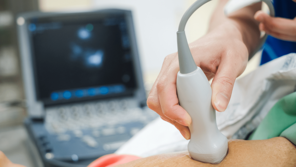 cardiac ultrasound CU